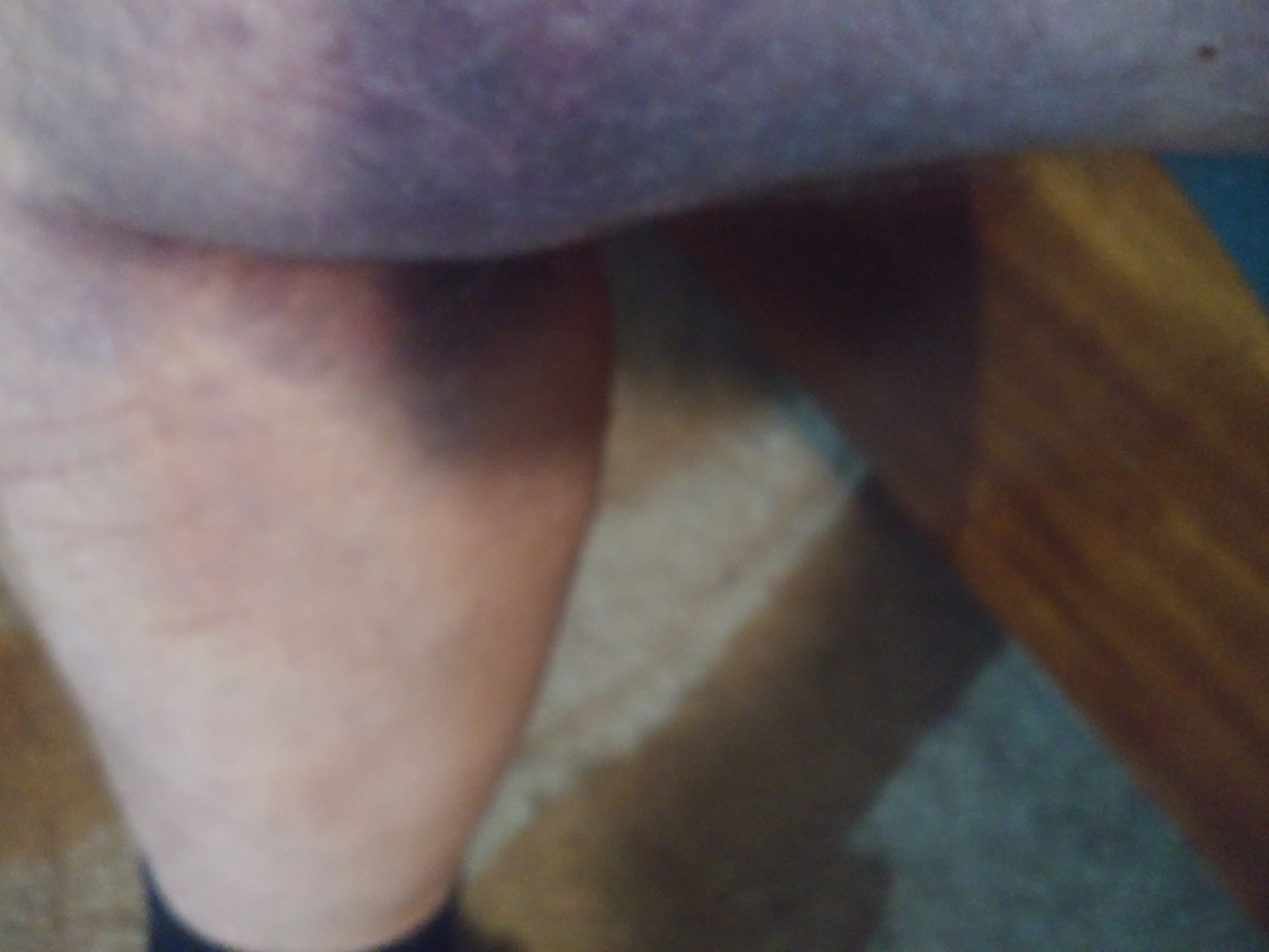 Thigh injury